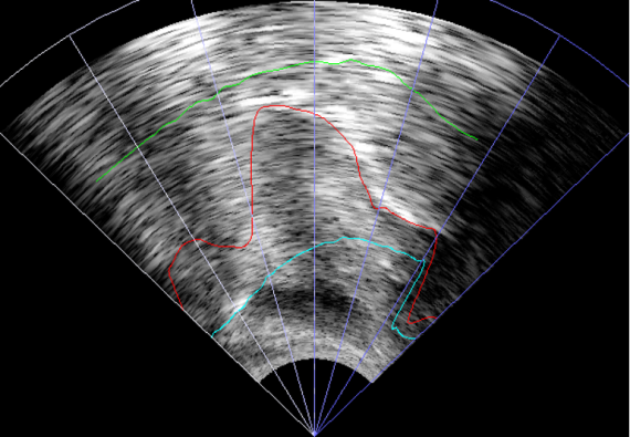 ultrasound_imaging